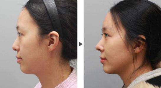 濟(jì)南中心醫(yī)院整形科去疤痕：康復(fù)效果如何？與他院相比有何優(yōu)劣之處？