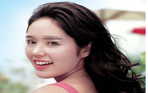 2023年鄭州哪家醫(yī)院做人工隆鼻效果好？推薦排名名單來了！