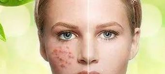 江蘇知名整形醫(yī)院推薦！2023年比較值得信賴的三甲醫(yī)院名單曝光！設(shè)備先進(jìn)，專業(yè)口碑為您保駕護(hù)航！