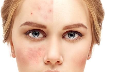 濟(jì)南胸產(chǎn)科哪家醫(yī)院好？完整評(píng)測(cè)指南，盡在這里！