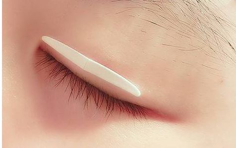 明星Monica進(jìn)行了整容手術(shù)？