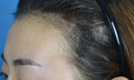 平頂山哪家整形醫(yī)院好？挑選合適的整形醫(yī)院必備的幾點參考