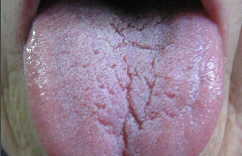 2023鄭州哪家整形醫(yī)院最適合抽脂提臀？排行榜前十值得收藏！