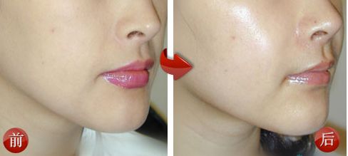 遵義祛疤痕醫(yī)院哪家好？詳細(xì)咨詢專業(yè)醫(yī)生，獲取獨(dú)家祛疤方案