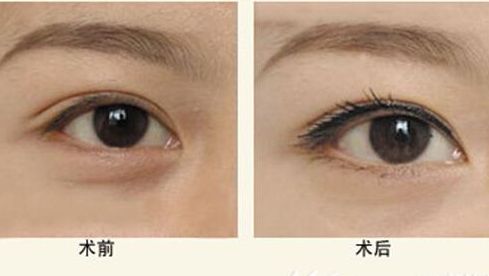 四川比較權(quán)威的整容醫(yī)院排名公布！你一定不能錯(cuò)過(guò)的名單！