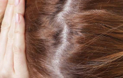 如何讓牙齒變得更白？牙黃星人必看！