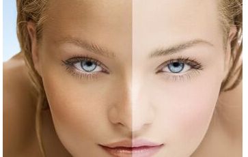 昆山看痘痘醫(yī)院哪家好？揭秘昆山市最受用戶信賴的痘痘醫(yī)院排名