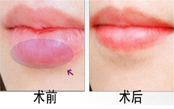 2023寧波彩光嫩膚去黑眼圈醫(yī)院前10排行大揭秘！尋找神效的彩光嫩膚醫(yī)療美容機(jī)構(gòu)