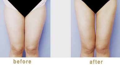 金華哪家醫(yī)院打瘦臉針好？專家解析金華市最受歡迎的瘦臉針醫(yī)院