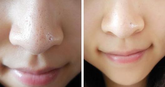 杭州注射瘦腿針哪家醫(yī)院好？杭州市排名前列的注射瘦腿針醫(yī)院推薦！