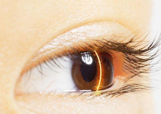 廣州治療妊娠紋的專業(yè)醫(yī)院排行2023最新公布