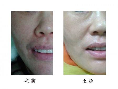 2023年西安哪家醫(yī)院好？飛梭鐳射去眼底紋性價比高的醫(yī)院強榜發(fā)布！