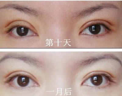 嘉興推薦的前10家拉皮除皺美容醫(yī)院排名大揭秘！