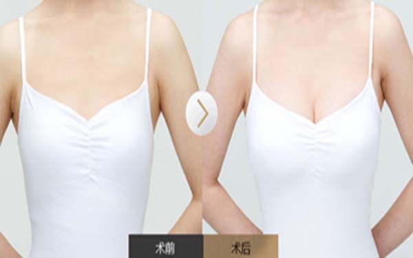 邢臺中醫(yī)優(yōu)秀整形美容醫(yī)院推薦，治痤瘡經(jīng)驗豐富！2023邢臺中醫(yī)整形醫(yī)院前十強，技術(shù)靠譜哪家？