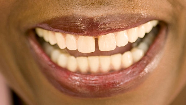 哪家醫(yī)院治療義烏線雕眼睛細(xì)紋比較有口碑？2023年前十大專業(yè)機(jī)構(gòu)揭曉！