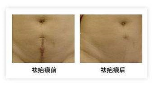 露華濃生姜洗發(fā)水脫發(fā)效果如何？治療效果真的有效嗎？