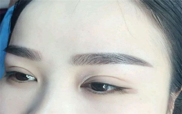 佛山十大玻尿酸祛唇紋口碑整形醫(yī)院推薦