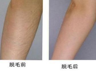 廣州兔唇修補(bǔ)術(shù)哪家醫(yī)院好？專家推薦的廣州兔唇修補(bǔ)術(shù)醫(yī)院大揭秘