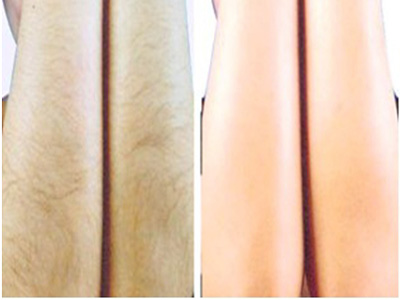 2023廣州面部填充自體脂肪醫(yī)院排行榜TOP10，高經(jīng)驗(yàn)專家推薦！