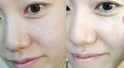 泉州整形手術(shù)，哪家醫(yī)院好？綜合排名及用戶口碑調(diào)查