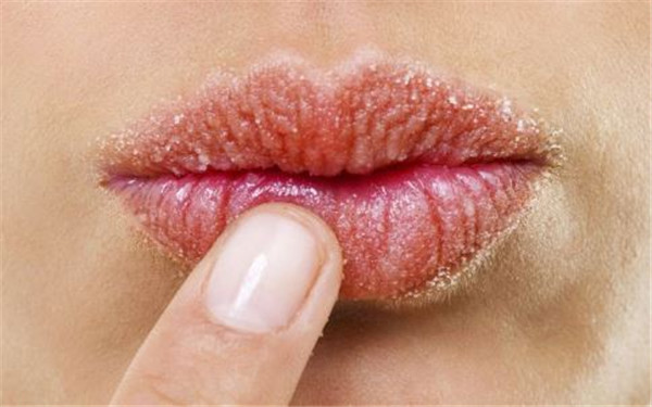 激光溶脂有什么優(yōu)勢和副作用？擁有令人驚嘆的效果，但是否安全值得考慮嗎？