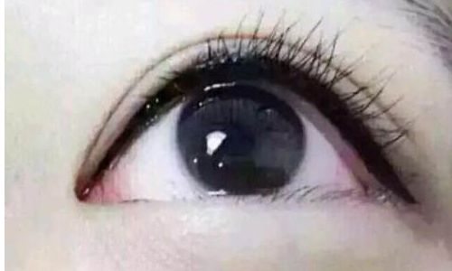 南昌祛斑醫(yī)院推薦：瑕疵拜拜，迎來無瑕肌