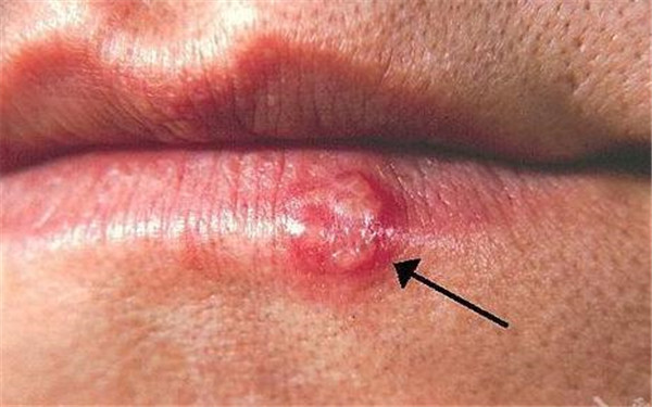 秦皇島哪些黃金微雕祛口周紋整形醫(yī)院性價比高？2023年排名前10有新動向！