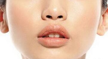 寧波打肉毒素哪家醫(yī)院好？綜合評(píng)測(cè)幫你選擇最適合的醫(yī)院！