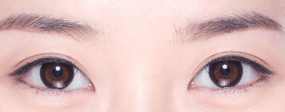 上海祛眼袋的醫(yī)院排名及專家推薦，哪家醫(yī)院靠譜？