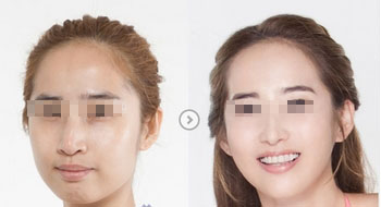 具惠善為何未能成功減肥？她不慎“品嘗”狗糧后效果減退？