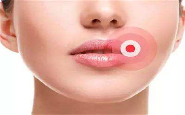 珠?？泼勒吾t(yī)院割雙眼皮哪位醫(yī)生技術(shù)高超？無效果的風(fēng)險高嗎？