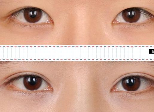 青島祛紅痘印整形美容醫(yī)院推薦：前十名榜單公開