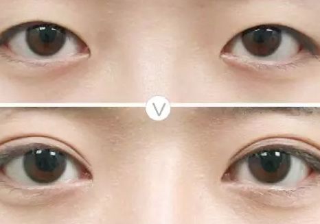 哈爾濱豐胸手術(shù)信息大揭秘！藝星、伊美爾、哈醫(yī)大二院等TOP5值得關(guān)注！