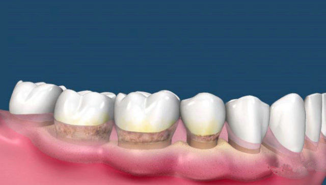 廈門哪家醫(yī)院耳廓缺損修復(fù)效果好？2023年廈門耳廓缺損修復(fù)排行榜前十大整形醫(yī)院