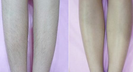 唐山整形美容醫(yī)院排名專業(yè)評測，哪家整形醫(yī)院口碑好？