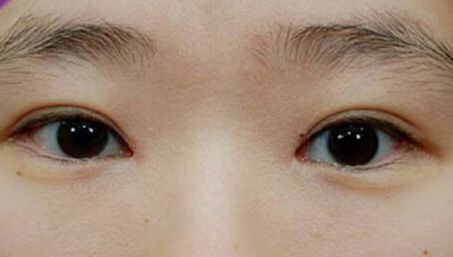 北京最值得推薦的面部提升醫(yī)師：受歡迎的口碑經(jīng)久不衰