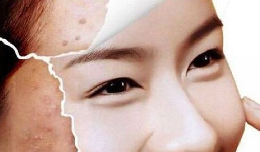 廣州整形注射隆鼻哪家好？綜合用戶評價，推薦這家！