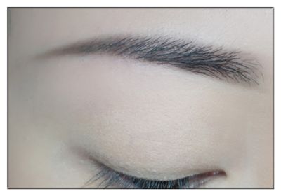 如何有效消除眼角皺紋？方法和費(fèi)用介紹！