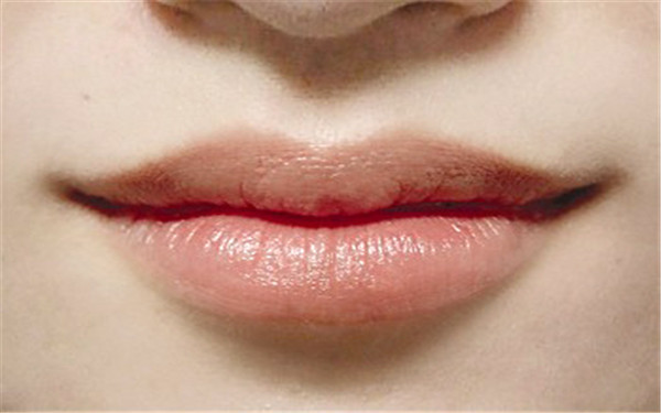 2023年上海下眼瞼眼袋整形醫(yī)院排行榜，這些專業(yè)機構質(zhì)量有保證！