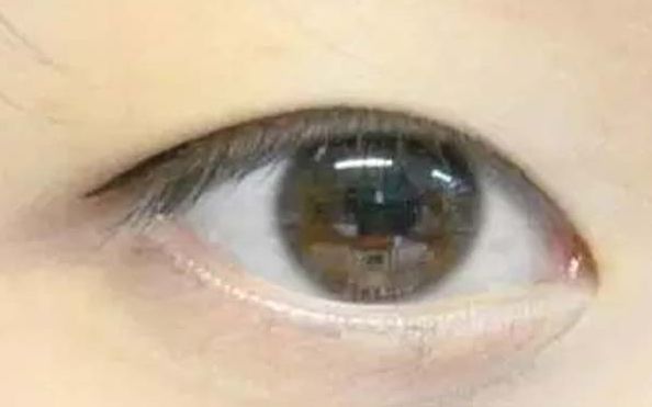 連云港市哪家美容醫(yī)院口碑好？