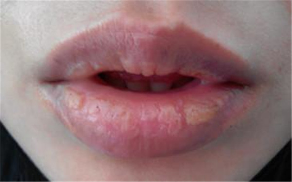 吉林下巴整形受歡迎的醫(yī)院有哪些？想要完美下巴，您需要知道的是……