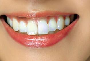 施悅吸脂靠譜嗎？是否值得一試