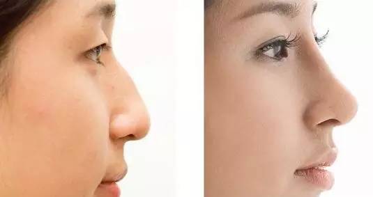 長春祛斑醫(yī)院匯總單前五評價(jià)反饋！是否有更新的祛斑價(jià)目表可供參考？