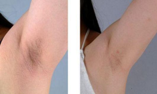 杭州瘦腿針醫(yī)院哪家好？選杭州瘦腿針醫(yī)院一定不要錯過這些關(guān)鍵因素！