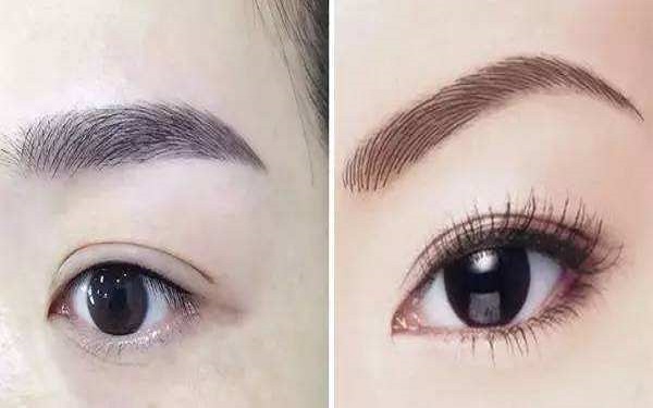 怎樣去除皺紋？忘記肌膚年齡，煥發(fā)青春活力!