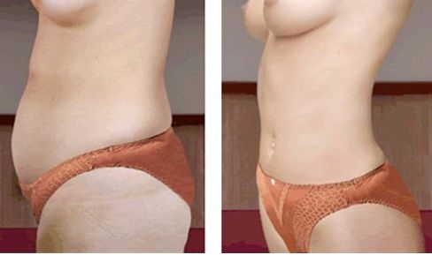 武漢祛眼袋醫(yī)院哪家好？2023最新排名出爐，專家推薦！