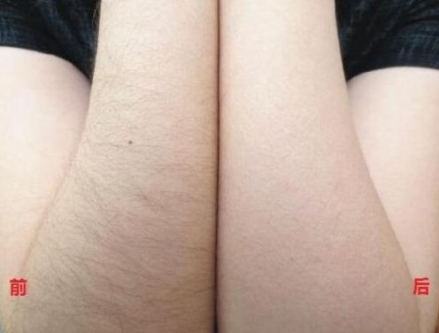 長(zhǎng)沙整形專(zhuān)家，專(zhuān)攻隆胸、祛斑、除皺等手術(shù)！驚喜價(jià)格揭曉！