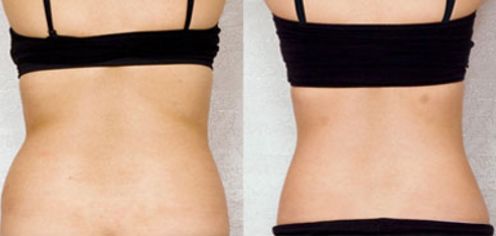 上海哪家青春痘治療效果好？探討多種治療方法，為您提供最佳選擇