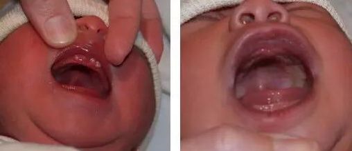 「2023年濮陽看痔瘡哪家醫(yī)院好？專家推薦+多人口碑回訪」