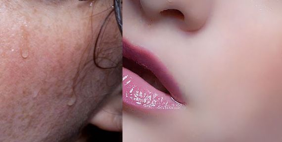 佛山祛痘印哪家醫(yī)院好？全面解析佛山專業(yè)祛痘印醫(yī)院榜單